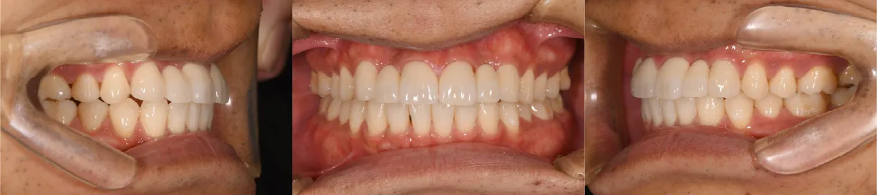 当歯科医院の特徴 難症例の実績